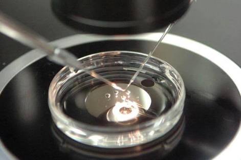 Fertilização in vitro: transferência de embriões sem fragmentos
