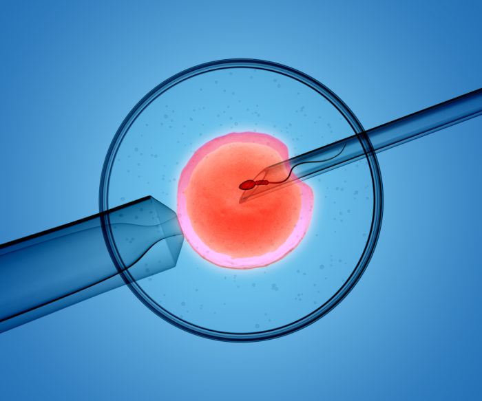 O que um casal precisa saber para fazer uma fertilização in vitro?